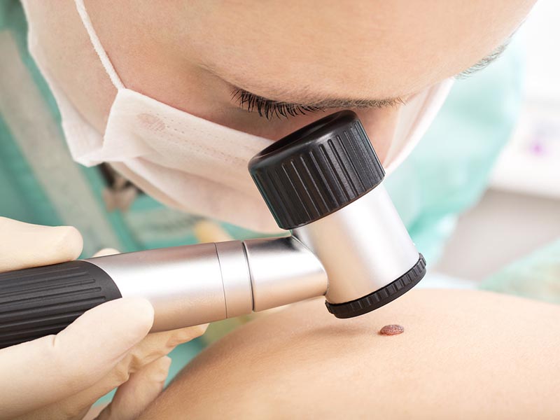 At What Ages Does Severe Obesity Affect Skin Quality?