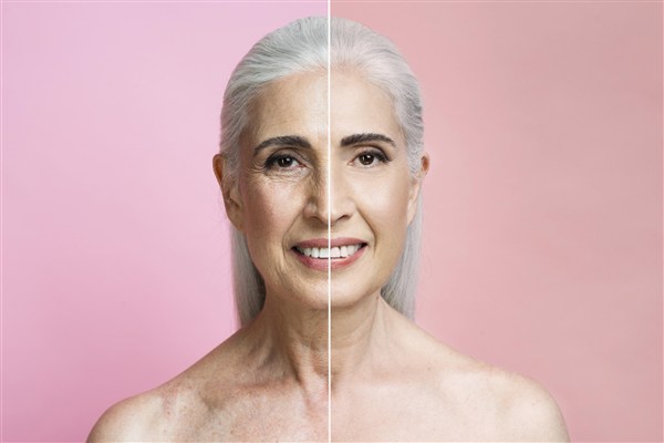 Defy Time with a Facelift