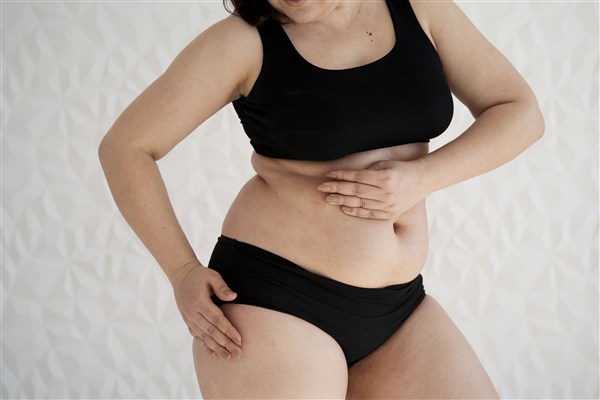 Liposuction
